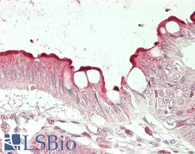 IHC-plus™ Polyclonal Rabbit anti-Human MBTPS1 / S1P Antibody (IHC, WB)