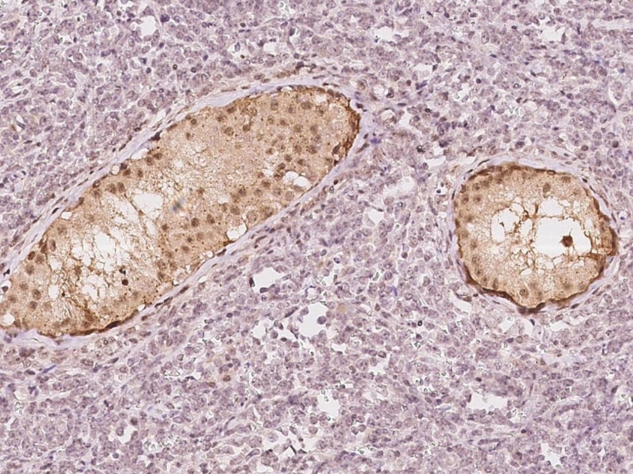 PGAM1 Antibody