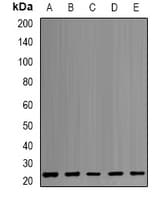 Polyclonal Rabbit anti-Human PSMB1 Antibody (IHC, IF, WB)