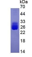 Human IL6 / Interleukin 6 Protein (Recombinant)