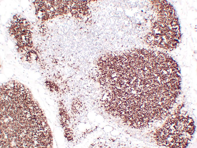 Monoclonal Mouse anti-Human CD1A Antibody (clone ABT-CD1a, IHC)