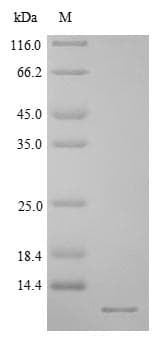 Rat CRYGB Protein (Recombinant 6His, N-terminus)