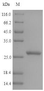 Pig GPX5 Protein (Recombinant 6His, N-terminus + Myc, C-terminus)