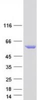 Human STK32C / PKE Protein (Recombinant Myc-DDK (Flag))