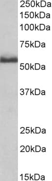 IHC-plus™ TNFRSF1B / TNFR2 Antibody (aa65-78)
