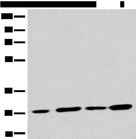 Polyclonal Rabbit anti-Human PNPO Antibody (IHC, WB)