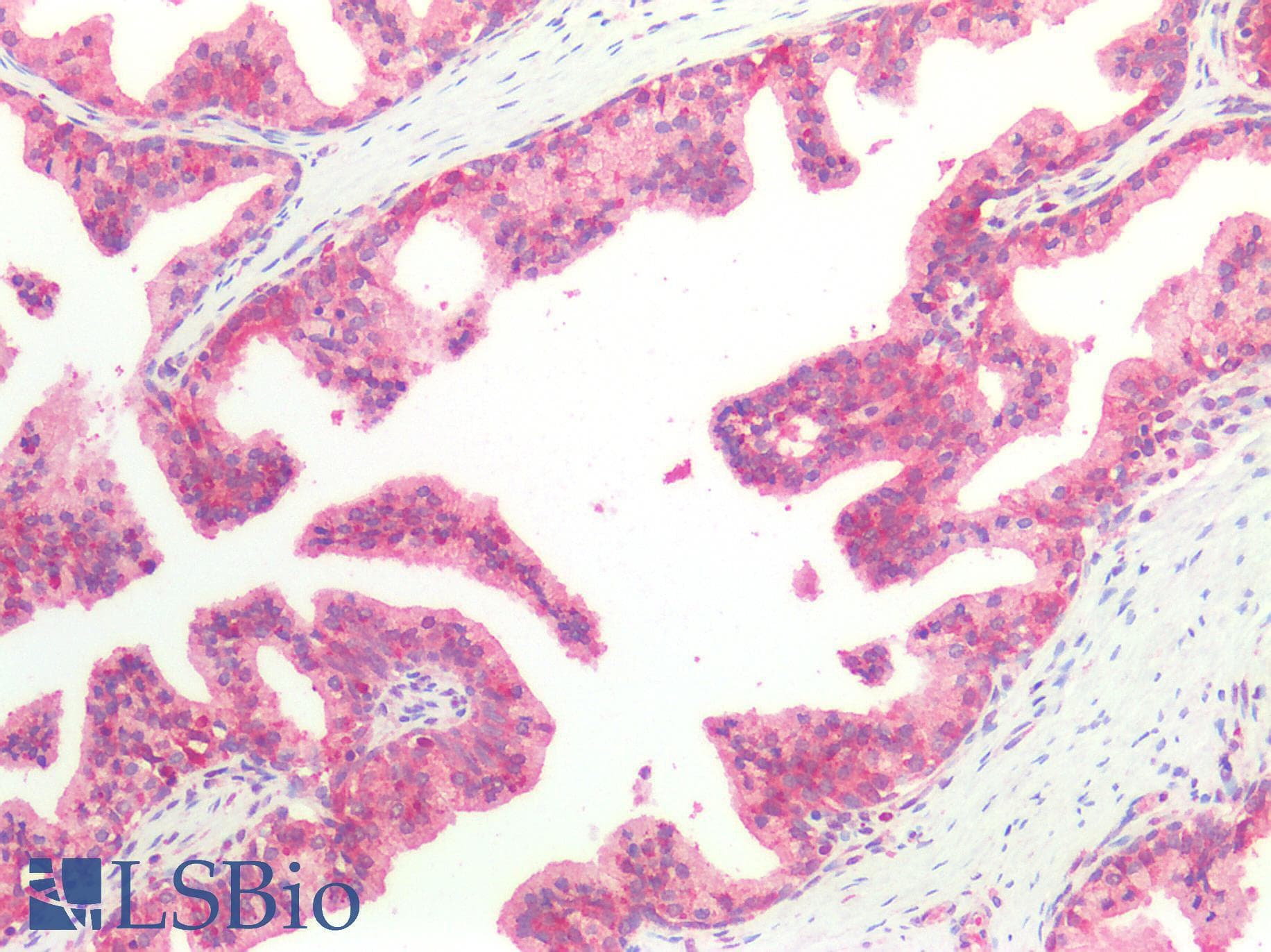 IHC-plus™ HSPA8 / HSC70 Antibody (Isoform 1)