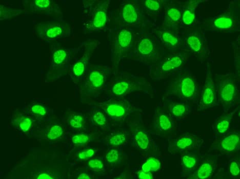 RFC1 / RFC Antibody