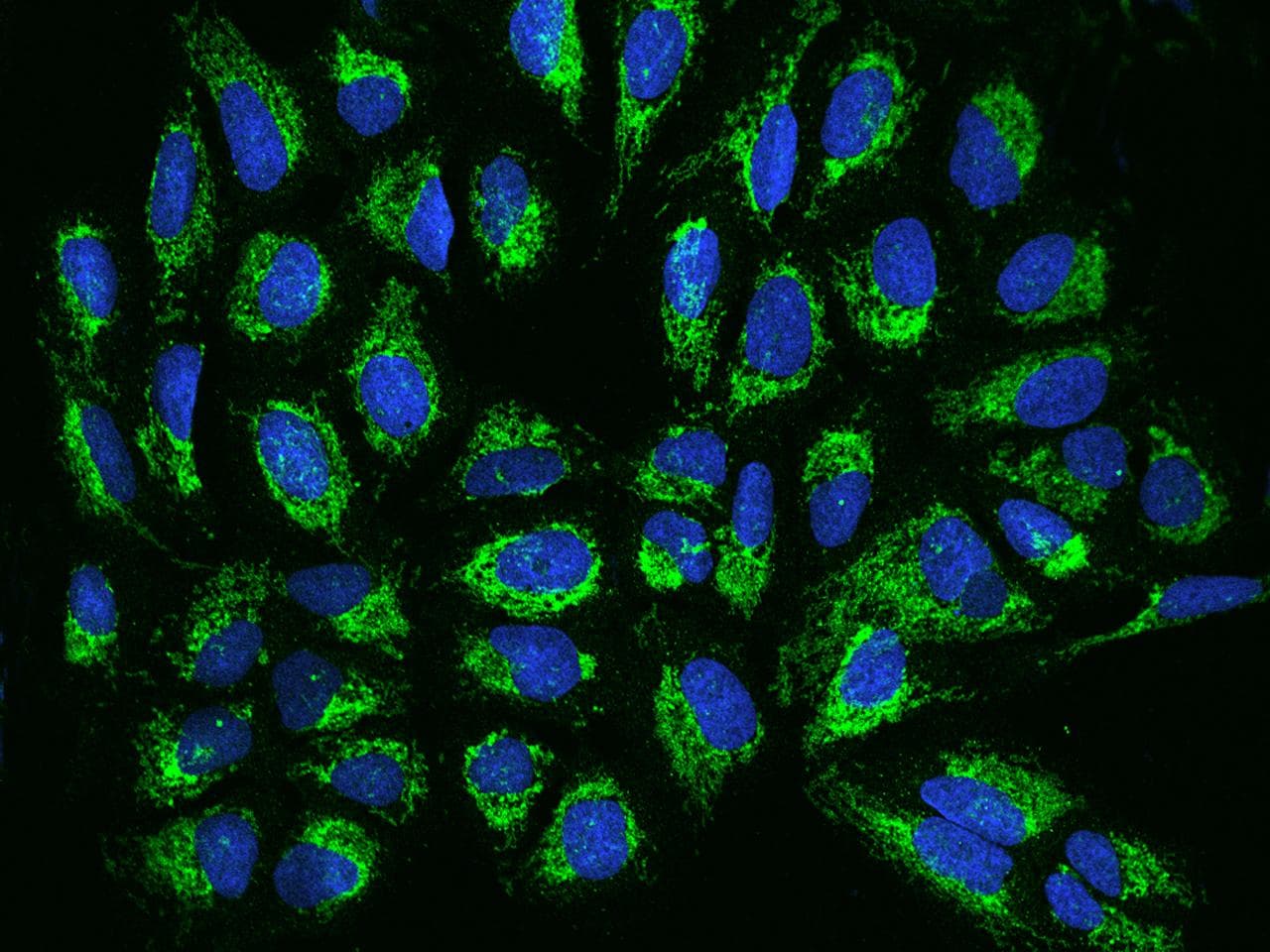Polyclonal Rabbit anti-Human TIMM17B Antibody (IF)