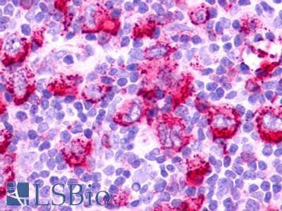 PathPlus™ GPR152 Antibody (Cytoplasmic Domain)