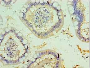Polyclonal Rabbit anti-Human TFF2 / SP Antibody (aa24-129, IHC)