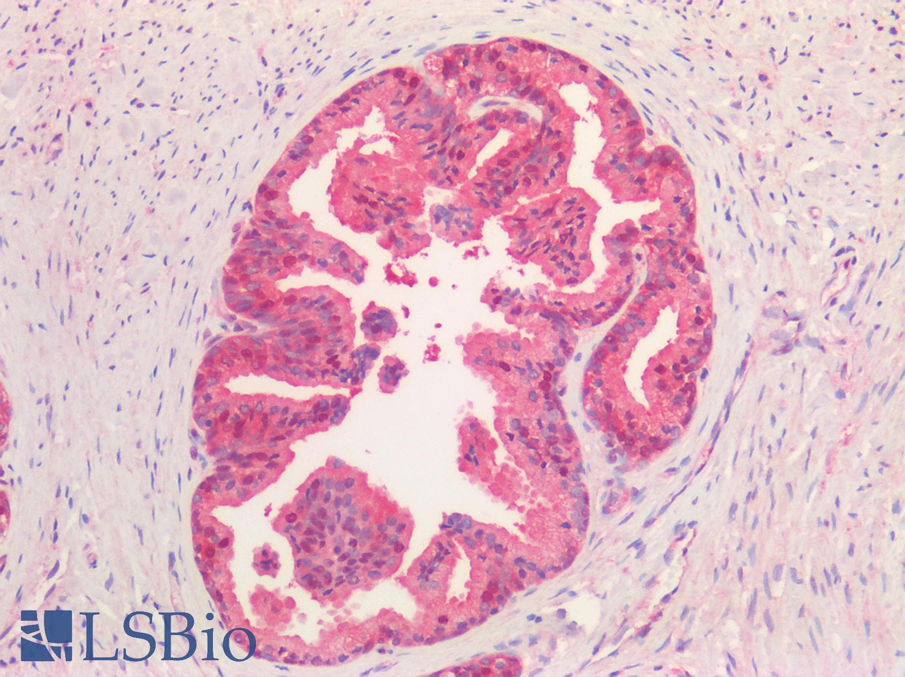 IHC-plus™ VCP Antibody (Internal Region)