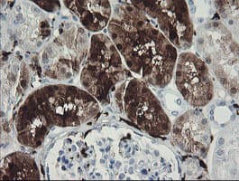 F13A1 / Factor XIIIa Antibody (clone OTI3E3, Carrier-free)