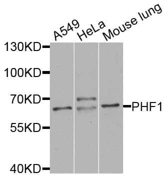 PHF1 Antibody
