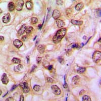 Histone Deacetylase HDAC5 / HDAC9 Antibody (phospho-Ser259/Ser220)