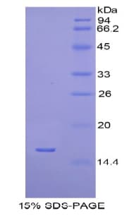 Human H2AFJ Protein (Recombinant His)