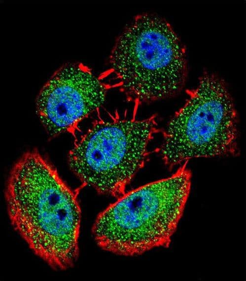 SPECC1 / CYTSB Antibody (aa705-733)