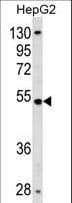 ZNF134 Antibody (aa139-167)