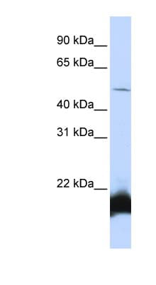 ONECUT1 / HNF6 Antibody (N-Terminus)