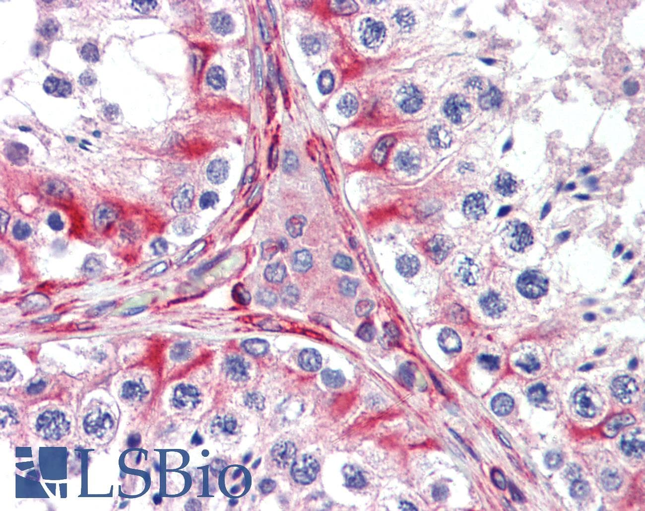 IHC-plus™ NEP / DDR1 Antibody (clone 2G4E12)