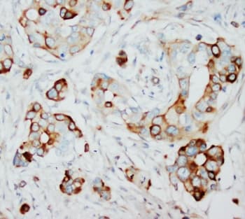 SKP2 Antibody (aa2-20)