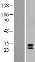 MPZL3 Protein (Over-Expression Lysate Myc-DDK (Flag))