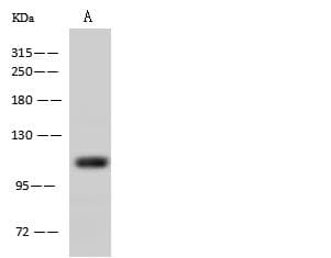 AARS Antibody