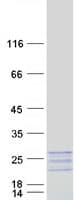 Human MYL7 Protein (Recombinant Myc-DDK (Flag))