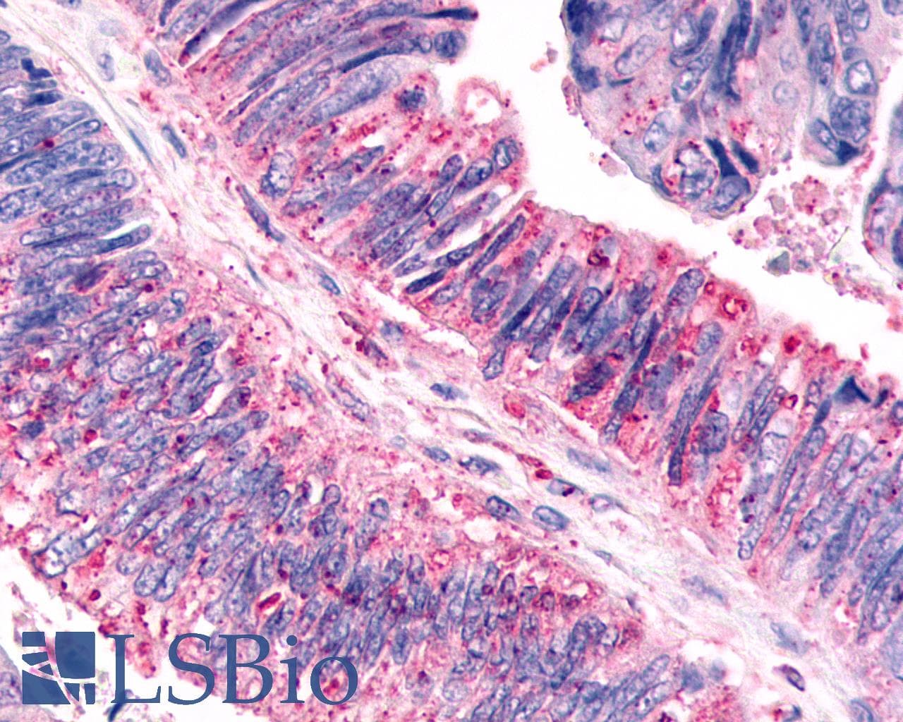PathPlus™ CELSR3 Antibody (N-Terminus)