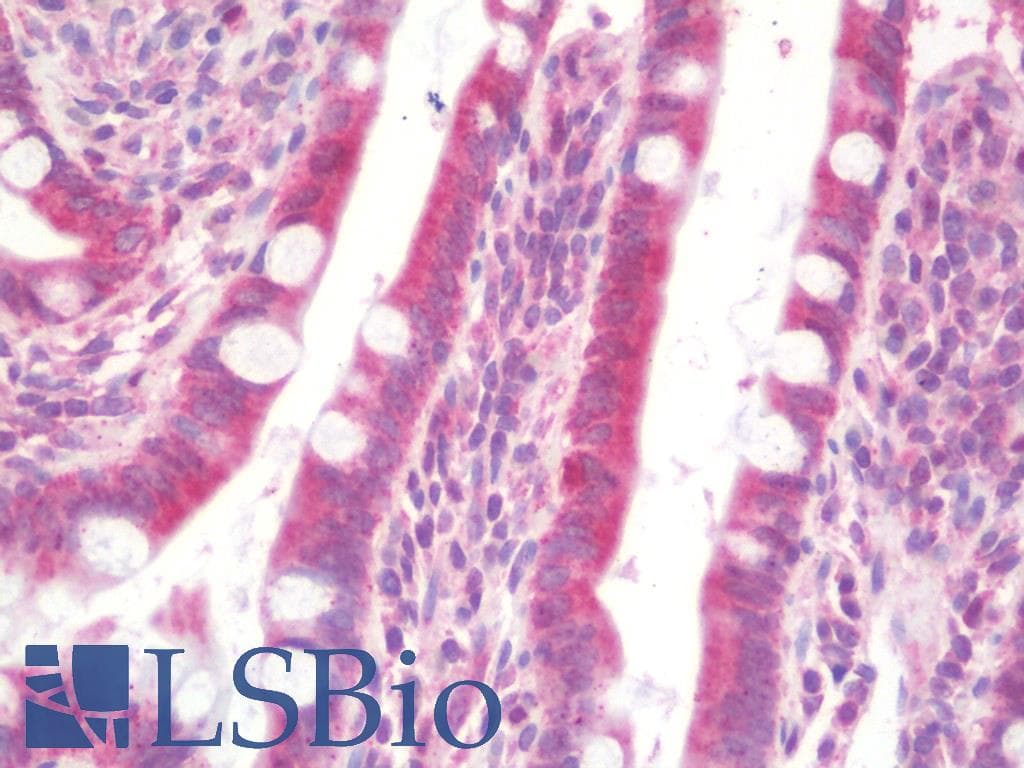 IHC-plus™ MTERF2 / MTERFD3 Antibody