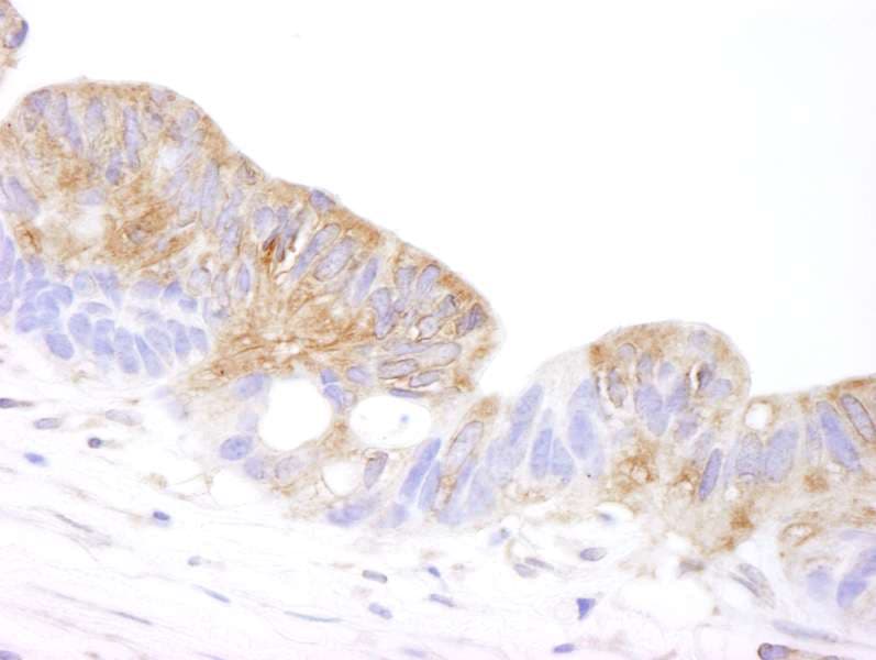 CORO1B Antibody (aa400-450)