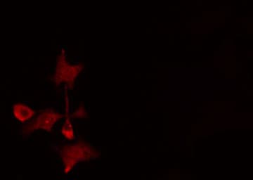 CMT2 / MAD2L1BP Antibody
