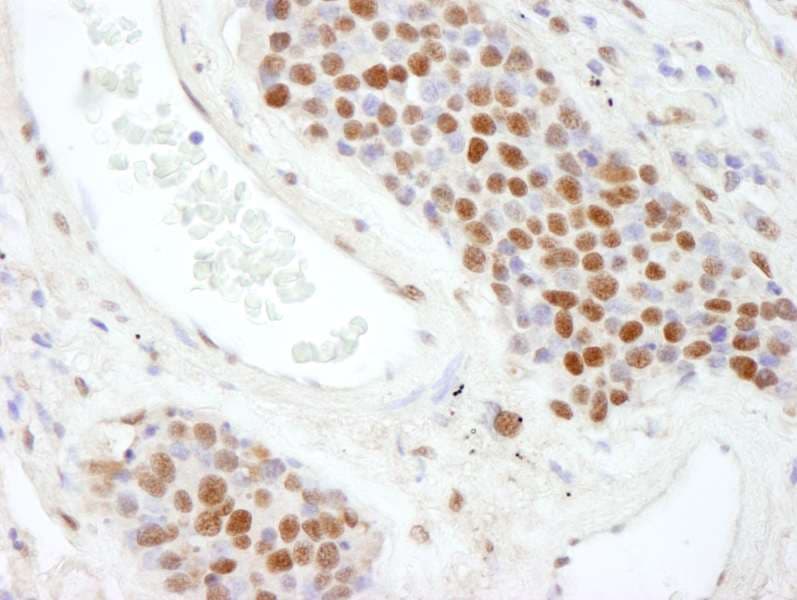 SAFB2 Antibody (aa175-225)