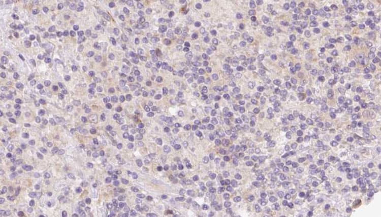 Polyclonal Rabbit anti-Human HOMER1 / Homer 1 Antibody (IHC, IF, WB)