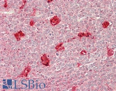 PathPlus™ CTSS / Cathepsin S Antibody (aa 115-331)