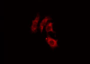 ACTN2 Antibody