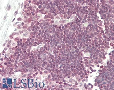 IHC-plus™ DAZAP1 Antibody (aa357-407)