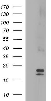 CLDN6 / Claudin 6 Antibody (clone OTI3E3)