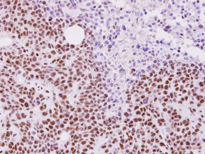 ALY / THOC4 Antibody (aa1-233)
