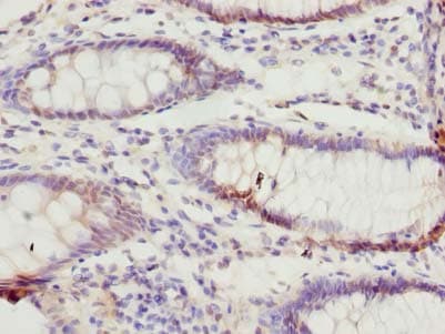 Polyclonal Rabbit anti-Human TTC38 Antibody (IHC, WB)