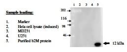 IHC-plus™ B2M / Beta 2 Microglobulin Antibody
