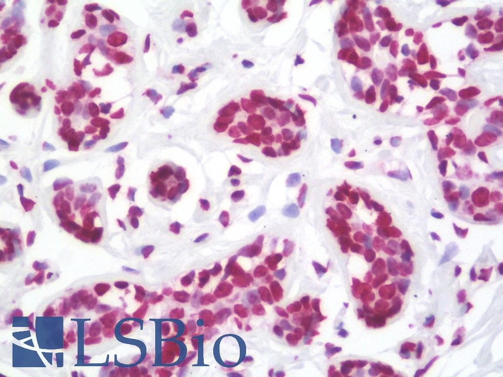 IHC-plus™ ER Alpha / Estrogen Receptor Antibody (aa53-301)