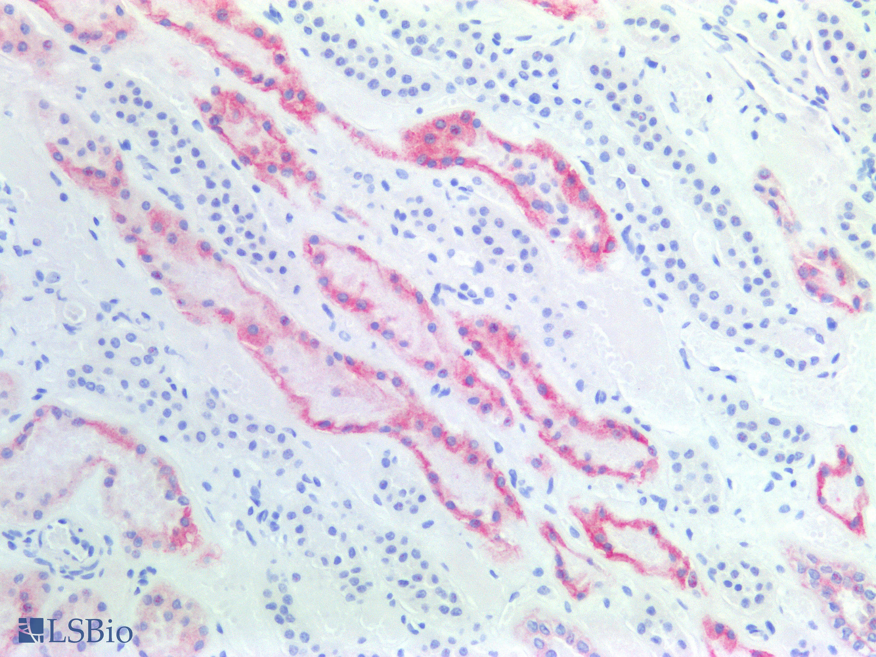 PathPlus™ KRT8 / CK8 / Cytokeratin 8 Antibody
