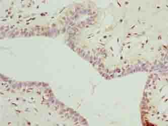Polyclonal Rabbit anti-Human DDX55 Antibody (IHC)