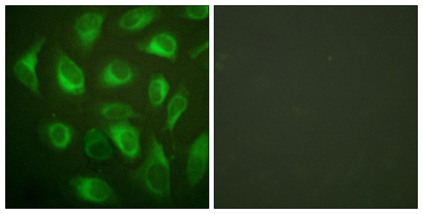 Polyclonal Rabbit anti-Human CANX / Calnexin Antibody (p583, IHC, IF, WB)
