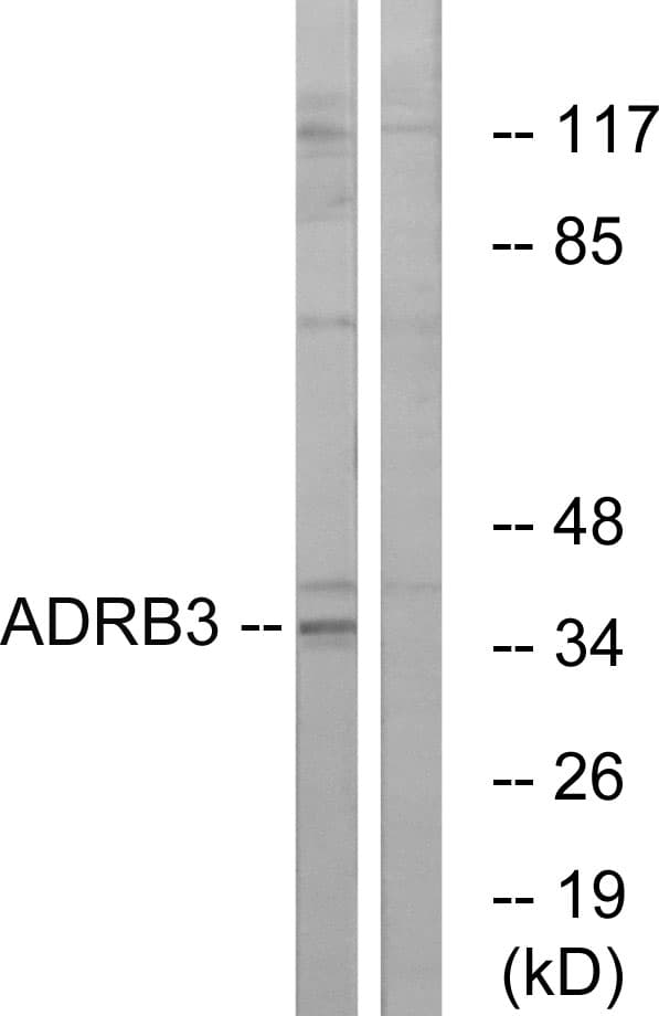 ADRB3 Antibody (aa250-299)