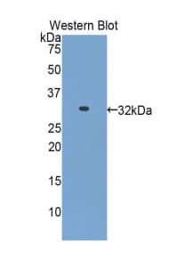HAS1 / HAS Antibody (aa164-421)