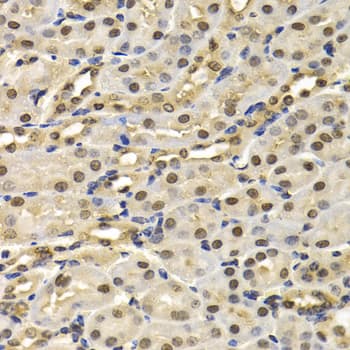 Cullin 4B / CUL4B Antibody