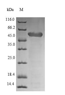 Staphylococcus aureus CwlM Protein (Recombinant 6His, N-terminus)
