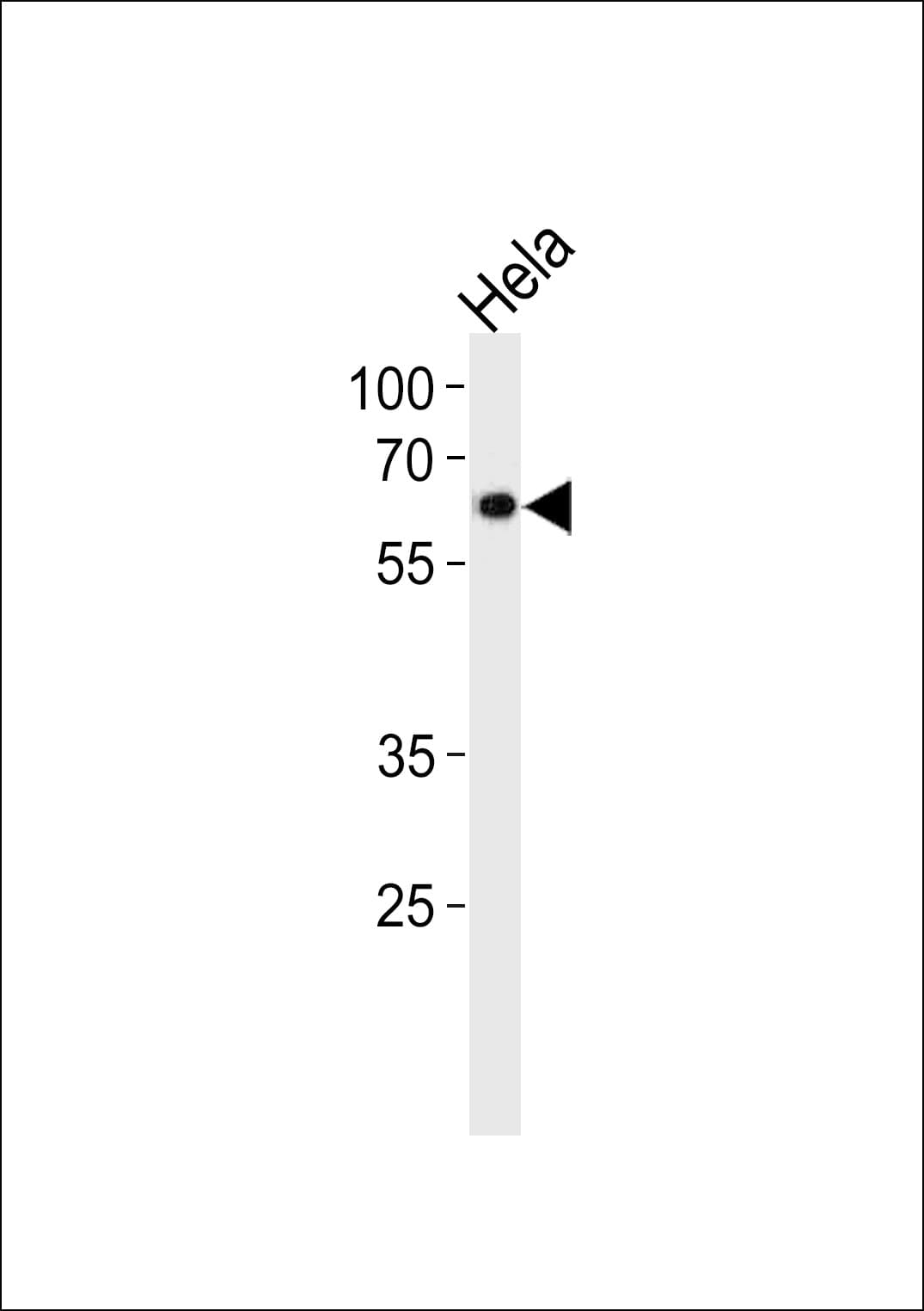 Polyclonal Rabbit anti-Human NR1D2 Antibody (aa266-294, IHC, WB)